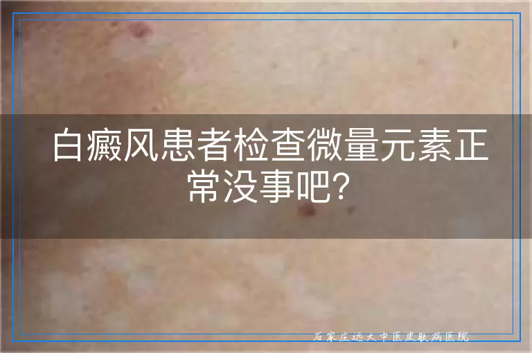 白癜风患者检查微量元素正常没事吧？