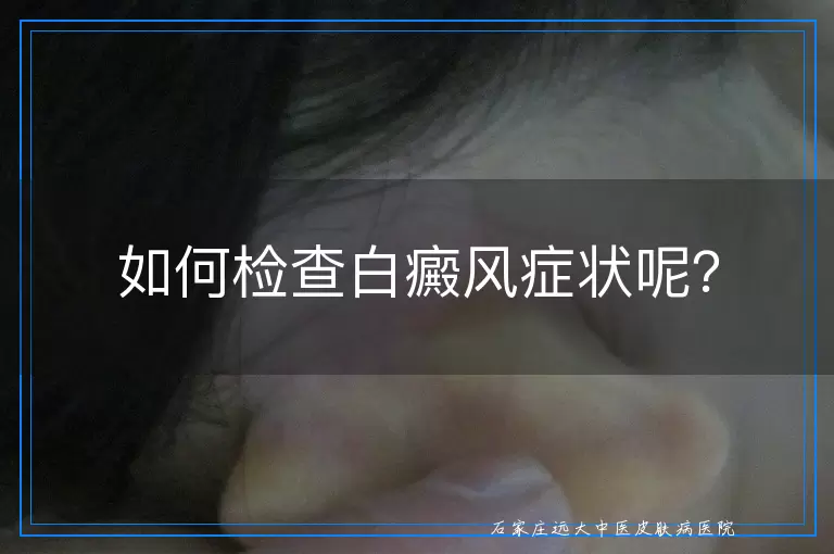 如何检查白癜风症状呢？