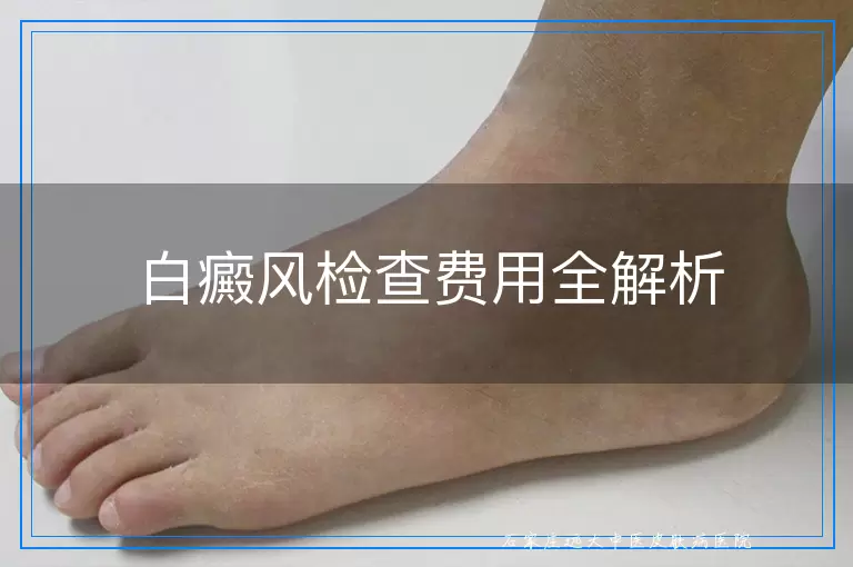 白癜风检查费用全解析