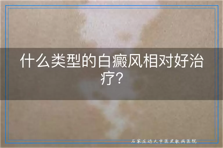 什么类型的白癜风相对好治疗？