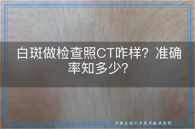 白斑做检查照CT咋样？准确率知多少？