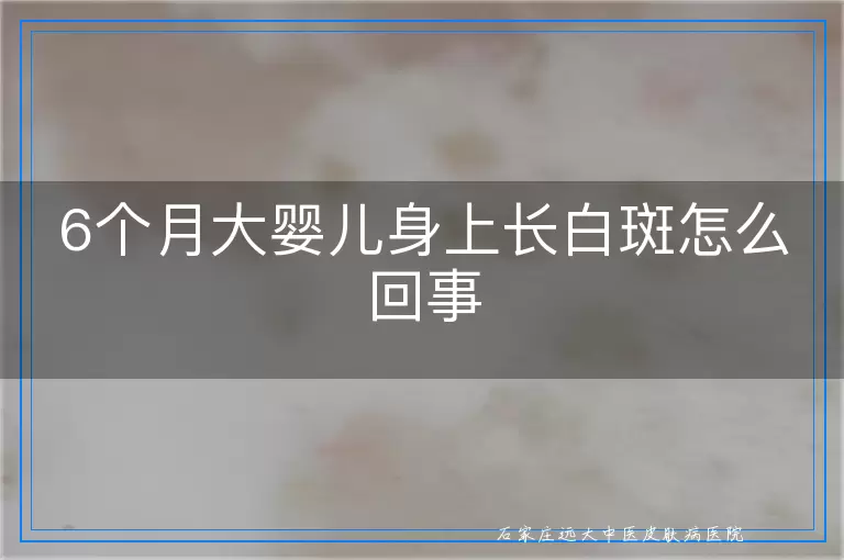 6个月大婴儿身上长白斑怎么回事