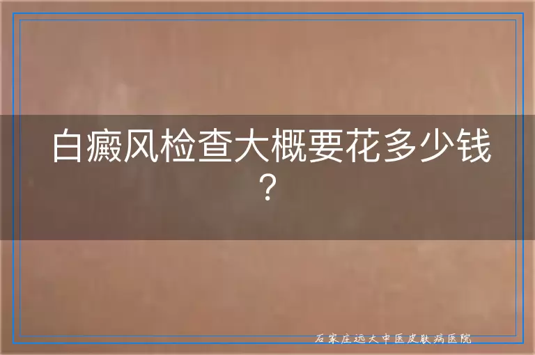 白癜风检查大概要花多少钱？
