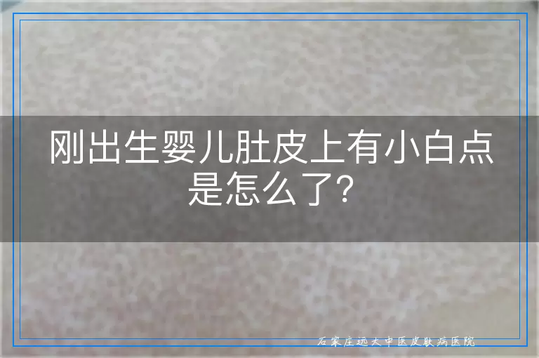 刚出生婴儿肚皮上有小白点是怎么了？