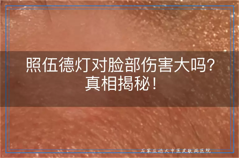 照伍德灯对脸部伤害大吗？真相揭秘！