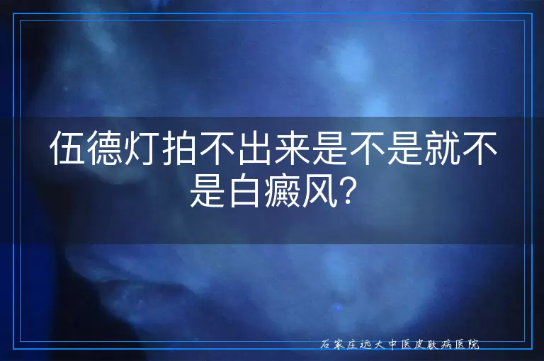伍德灯拍不出来是不是就不是白癜风？