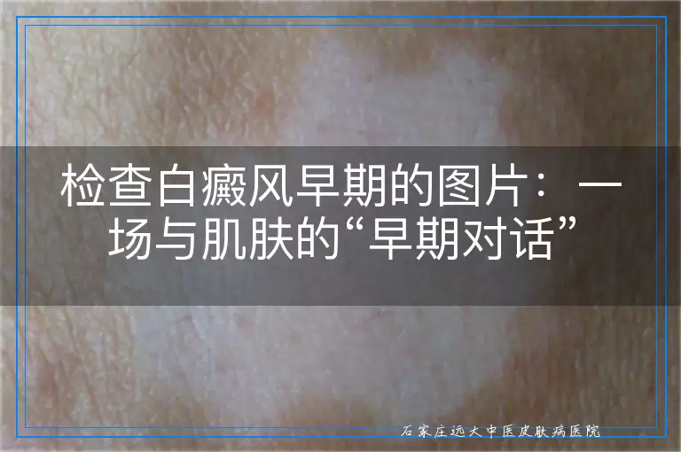 检查白癜风早期的图片：一场与肌肤的“早期对话”