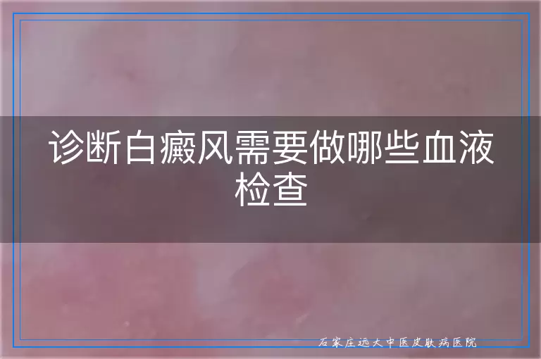 诊断白癜风需要做哪些血液检查