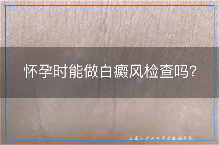 怀孕时能做白癜风检查吗？