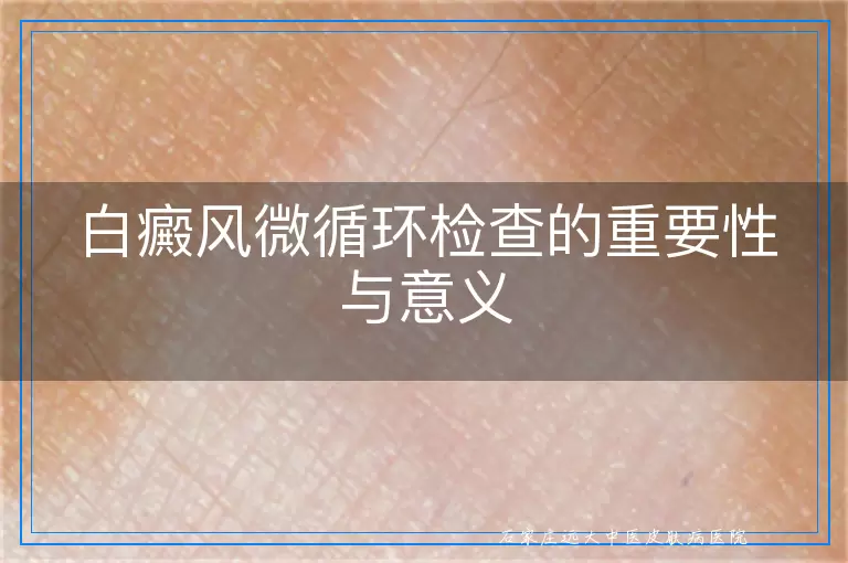 白癜风微循环检查的重要性与意义