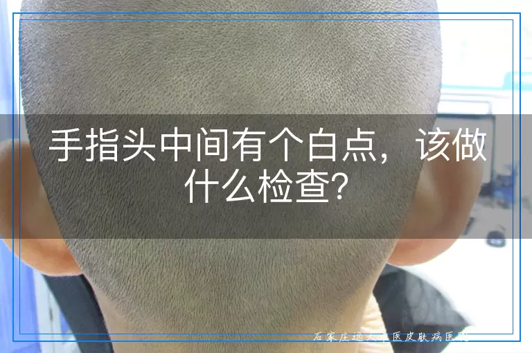 手指头中间有个白点，该做什么检查？