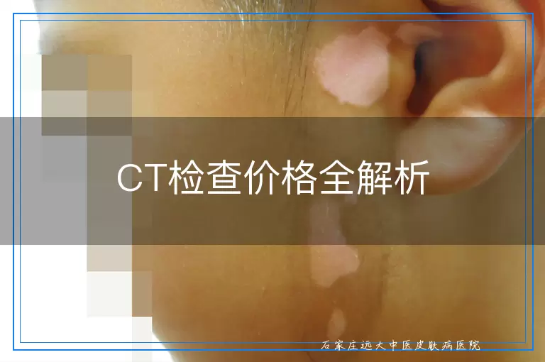 CT检查价格全解析