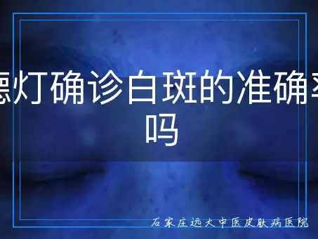 伍德灯确诊白斑的准确率高吗