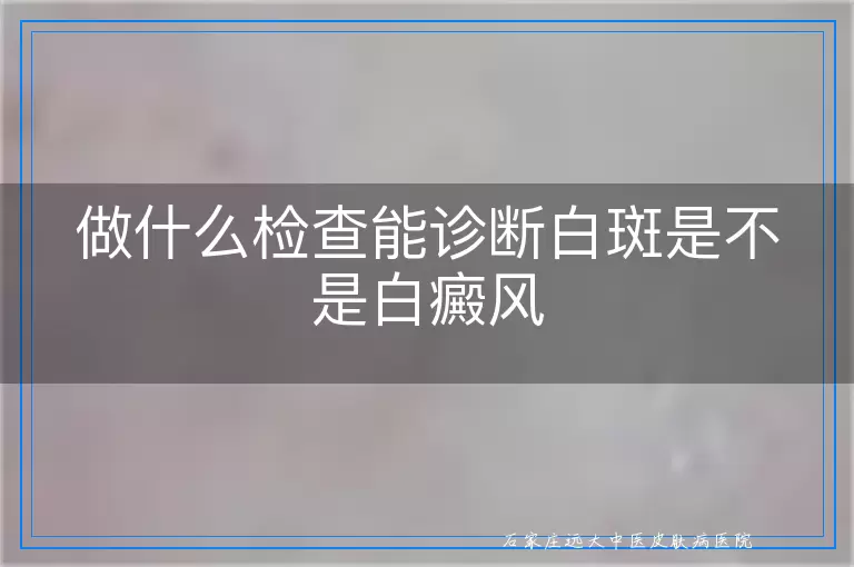 做什么检查能诊断白斑是不是白癜风