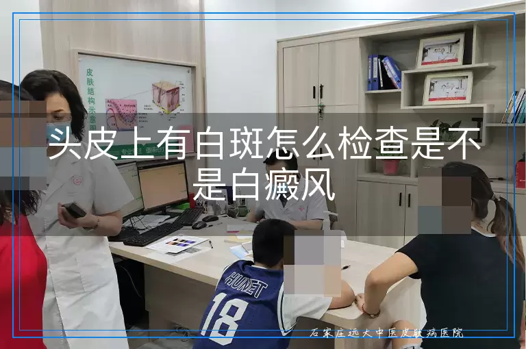 头皮上有白斑怎么检查是不是白癜风