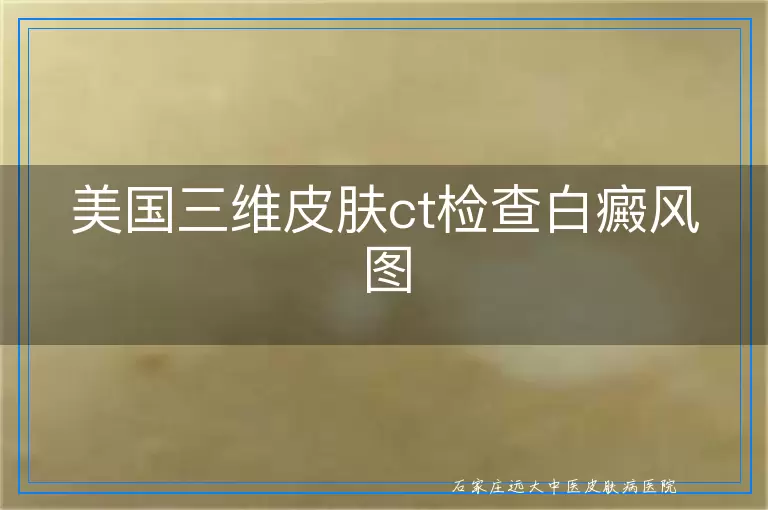 美国三维皮肤ct检查白癜风图