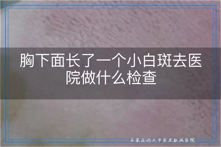 胸下面长了一个小白斑去医院做什么检查