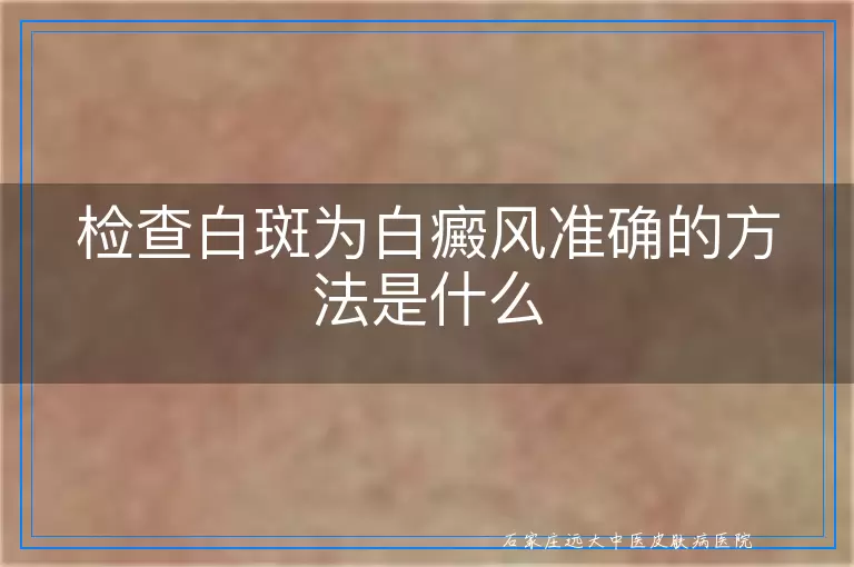 检查白斑为白癜风准确的方法是什么