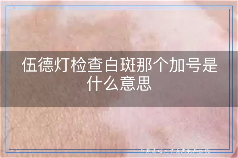 伍德灯检查白斑那个加号是什么意思