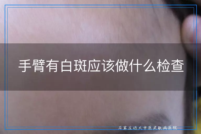 手臂有白斑应该做什么检查