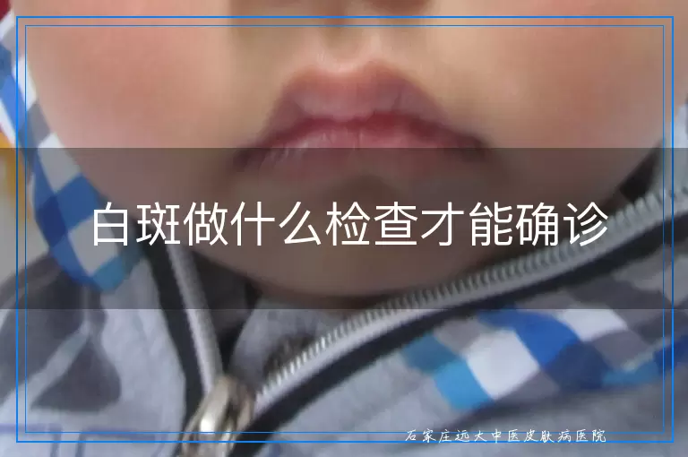白斑做什么检查才能确诊