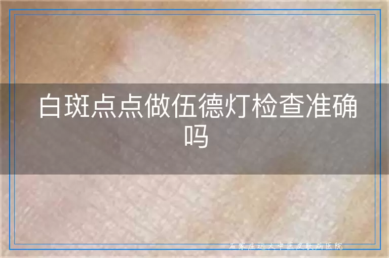 白斑点点做伍德灯检查准确吗