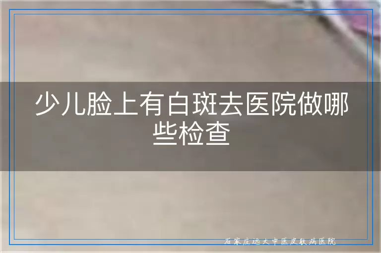 少儿脸上有白斑去医院做哪些检查