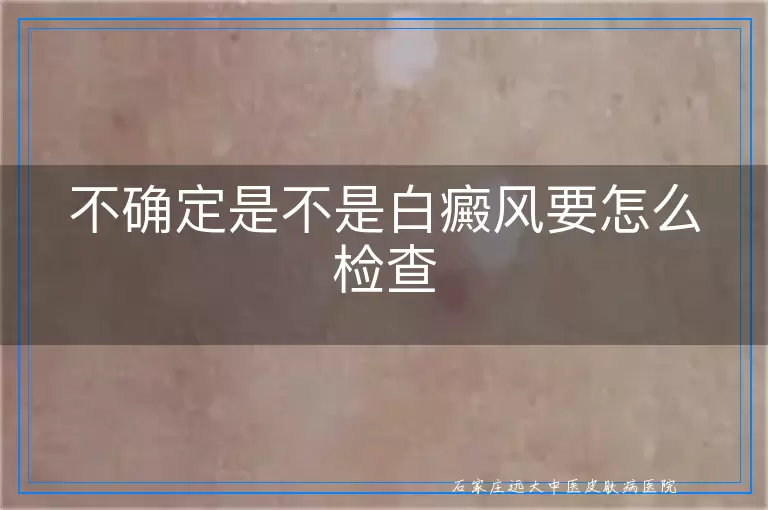 不确定是不是白癜风要怎么检查