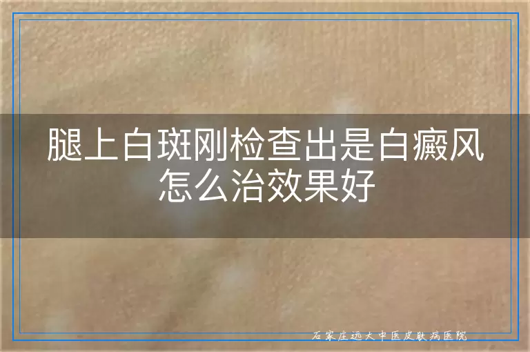 腿上白斑刚检查出是白癜风怎么治效果好