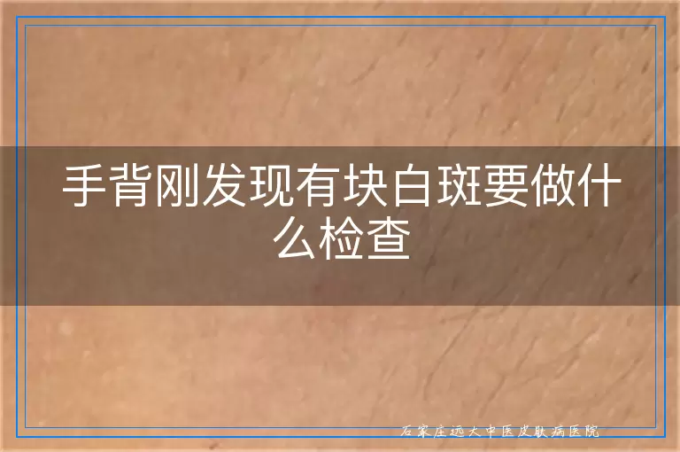 手背刚发现有块白斑要做什么检查