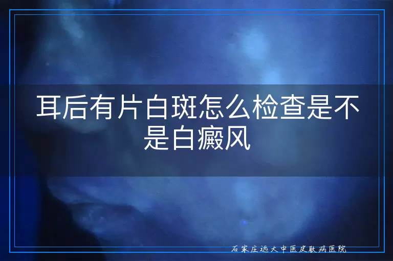 耳后有片白斑怎么检查是不是白癜风