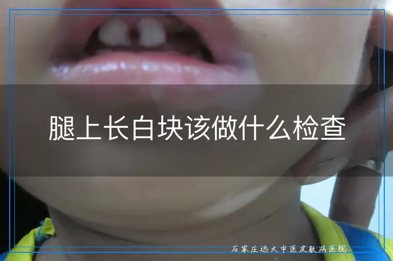 腿上长白块该做什么检查