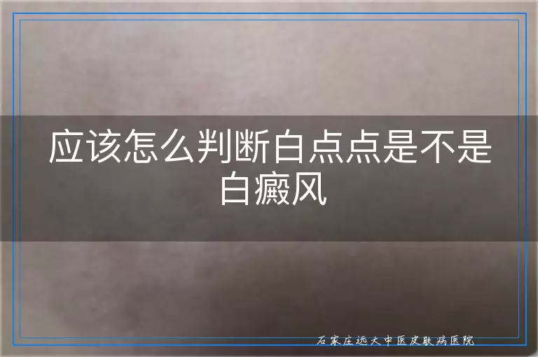应该怎么判断白点点是不是白癜风