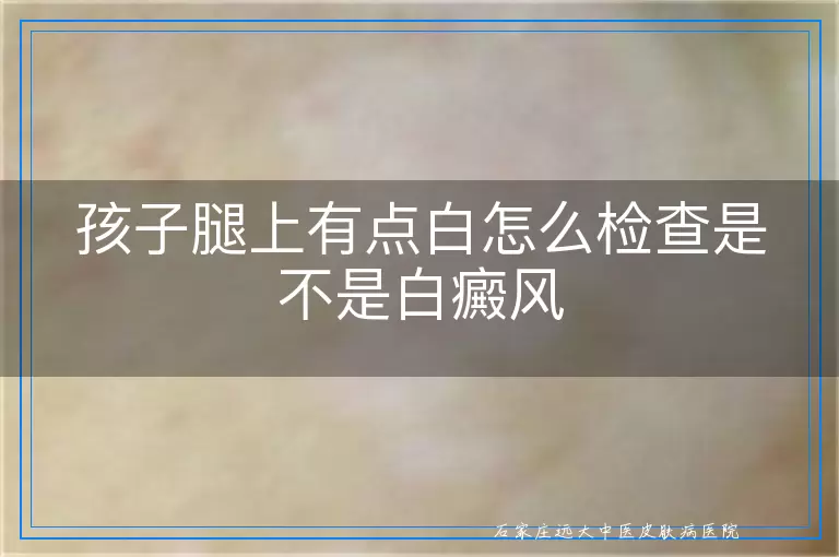 孩子腿上有点白怎么检查是不是白癜风