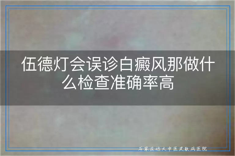 伍德灯会误诊白癜风那做什么检查准确率高