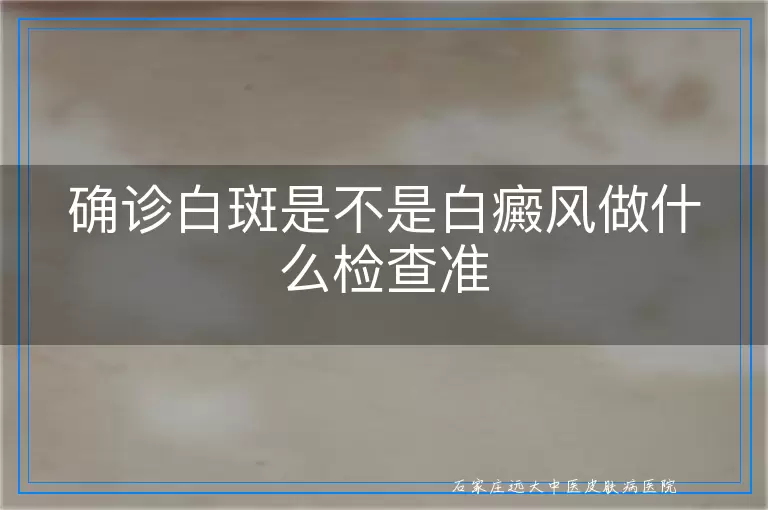 确诊白斑是不是白癜风做什么检查准