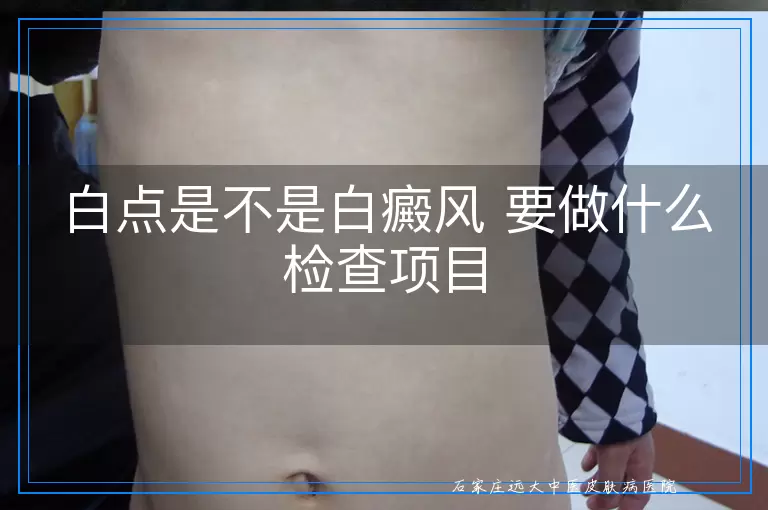 白点是不是白癜风 要做什么检查项目