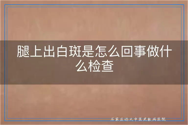 腿上出白斑是怎么回事做什么检查