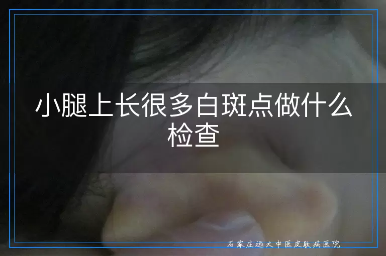 小腿上长很多白斑点做什么检查