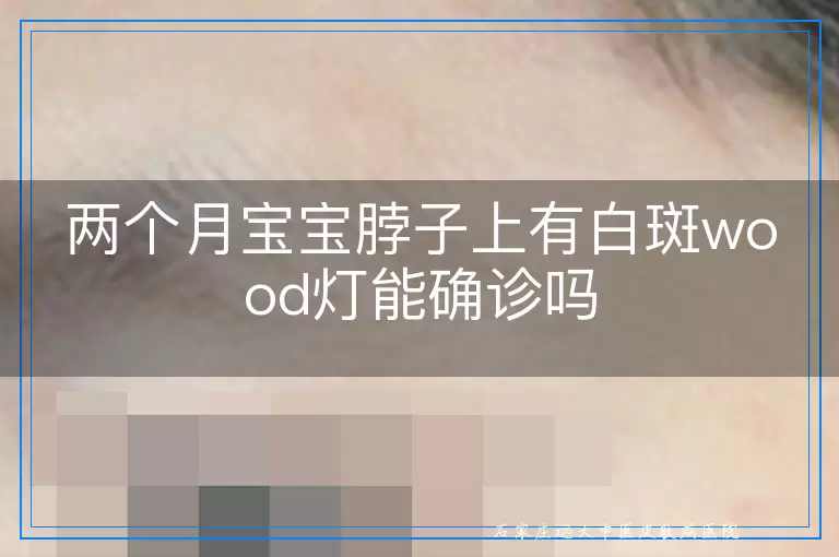 两个月宝宝脖子上有白斑wood灯能确诊吗