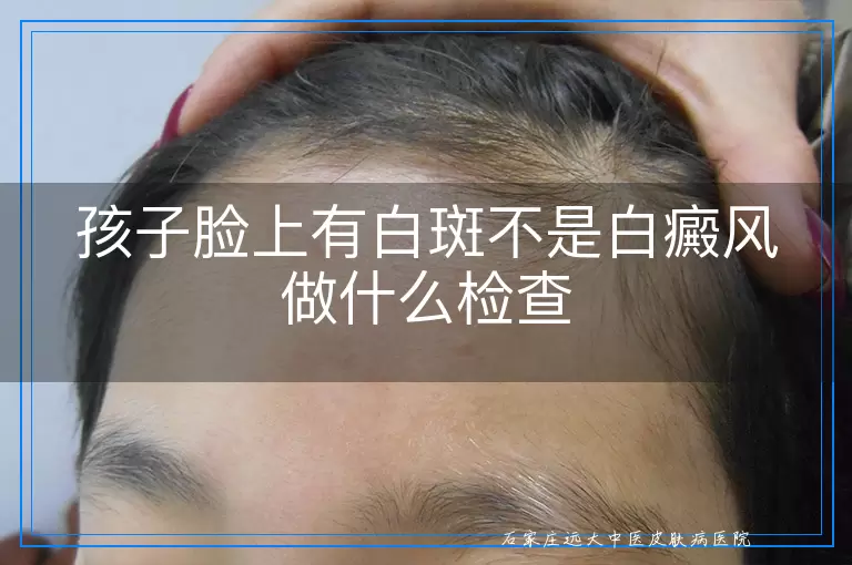 孩子脸上有白斑不是白癜风做什么检查