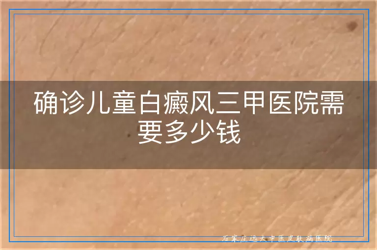 确诊儿童白癜风三甲医院需要多少钱