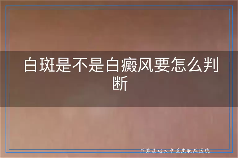 白斑是不是白癜风要怎么判断