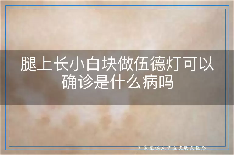 腿上长小白块做伍德灯可以确诊是什么病吗