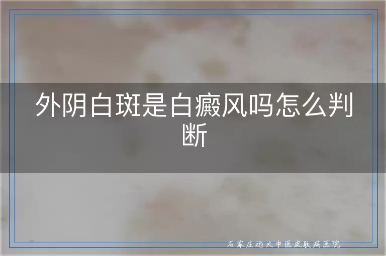 外阴白斑是白癜风吗怎么判断
