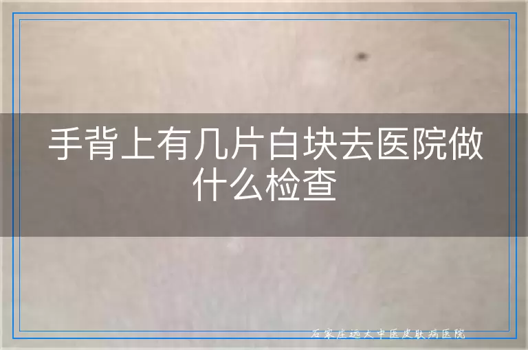 手背上有几片白块去医院做什么检查