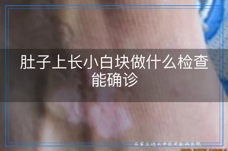 肚子上长小白块做什么检查能确诊