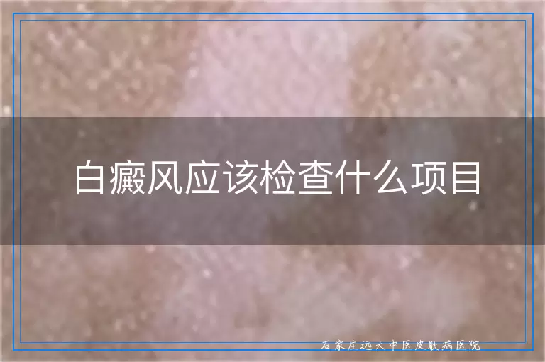 白癜风应该检查什么项目