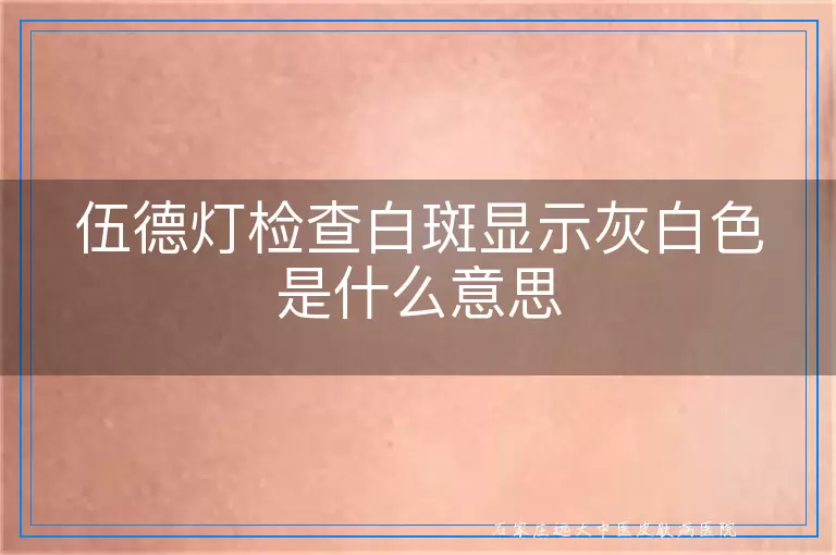 伍德灯检查白斑显示灰白色是什么意思