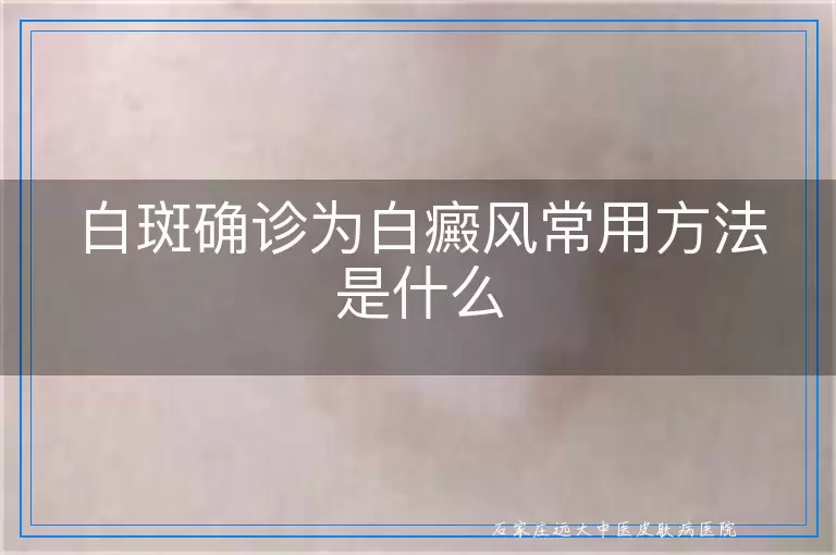白斑确诊为白癜风常用方法是什么